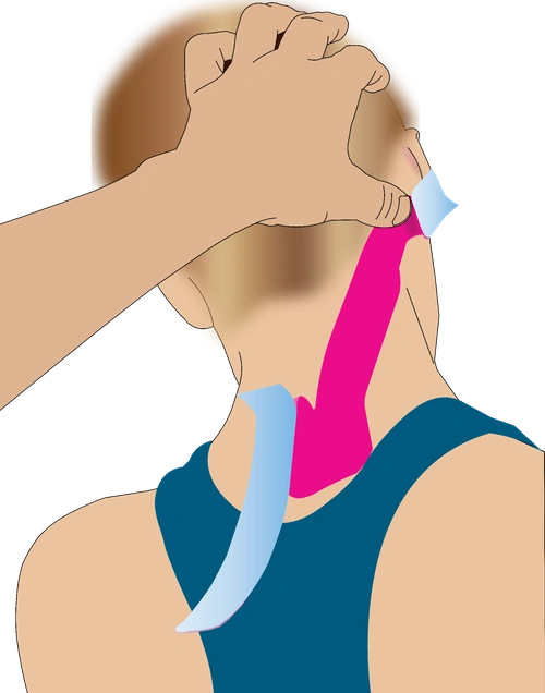 Neck taping step 2
