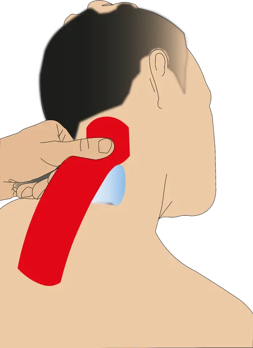 Neck and shoulder taping step 2